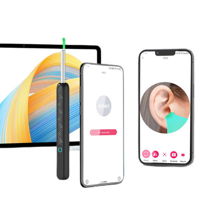 Halo Wireless Visual Ear Cleaner - 3.5mm HD Ear Camera with LED Lights